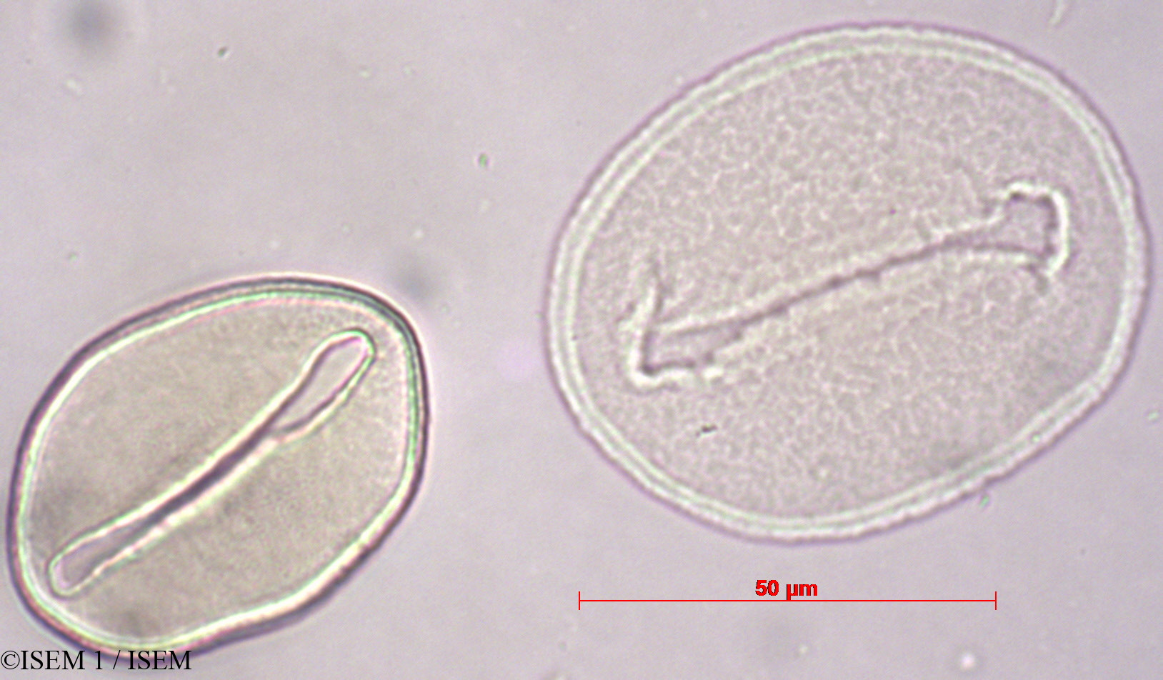 ISEM 1/Oenocarpus_bataua_29447/Oenocarpus_bataua_29447_0001(copy).jpg